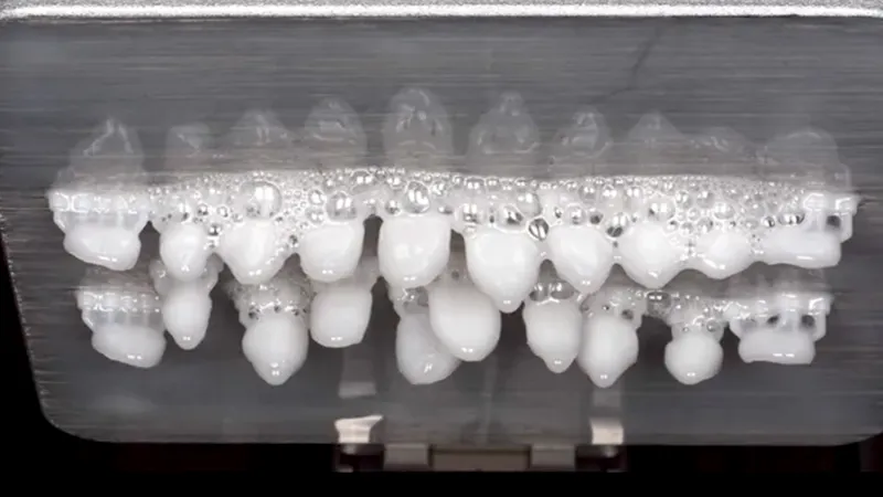 Veneers Veneers