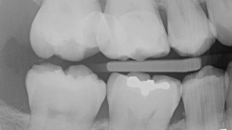 Dental x-ray Dental x-ray