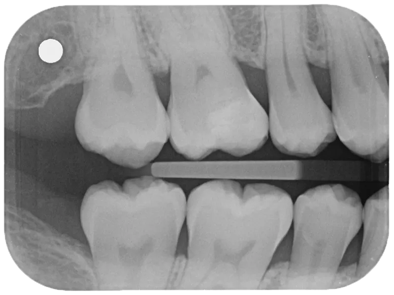 Dental x-ray Dental x-ray