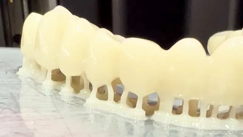 full-arch rehabilitation full-arch rehabilitation